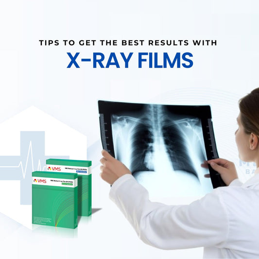 The Art of Image Clarity: Tips to Get the Best Results with X-Ray Films
