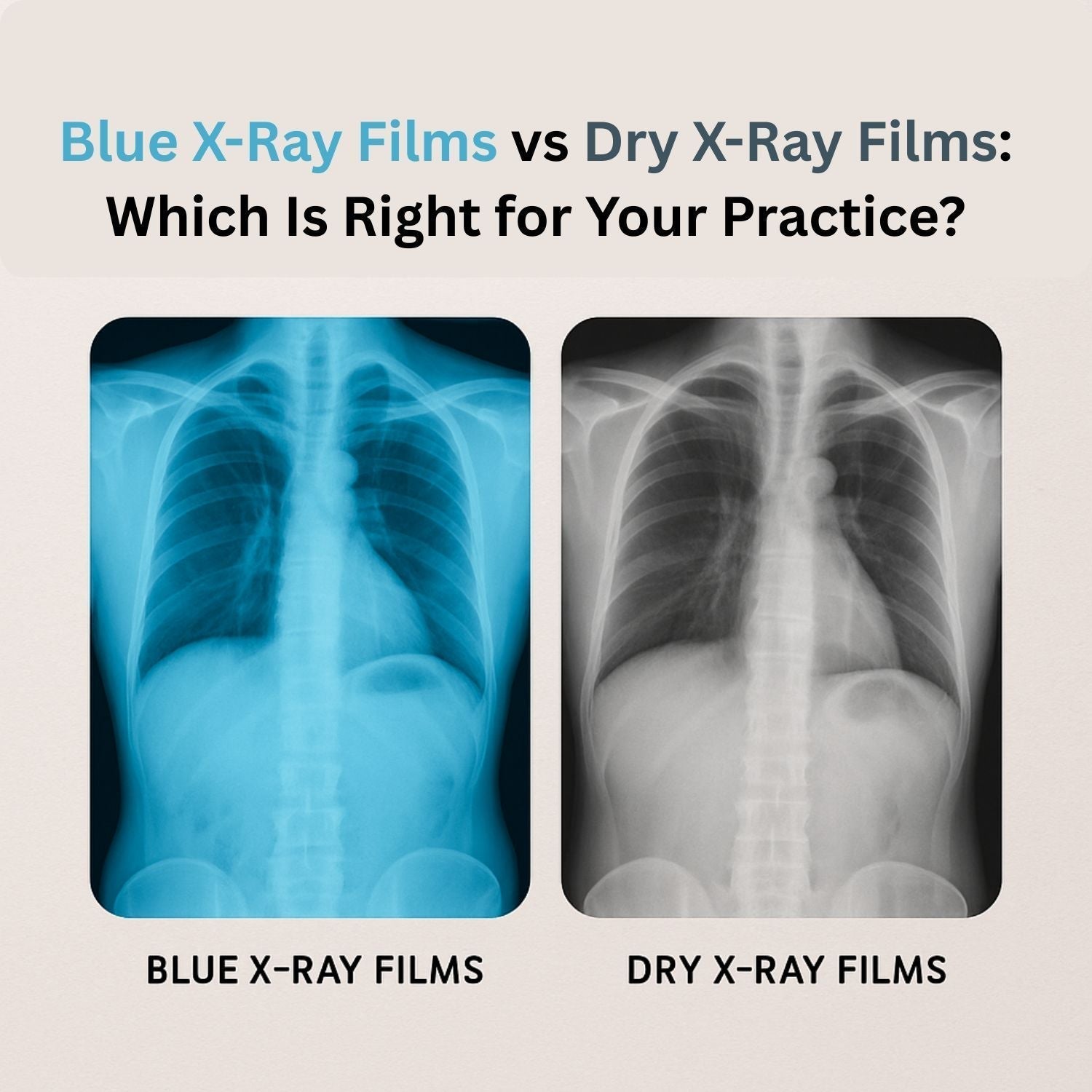 Blue vs Dry X-Ray Films | Which Is Best for Your Medical Practice ...