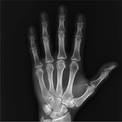 VMS Medical 10x12 X-Ray Hi-Speed Film - Blue Sensitive X-ray Hand 